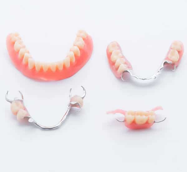 Four dental prosthetics and denture models displayed on white background showing different partial and complete denture designs.