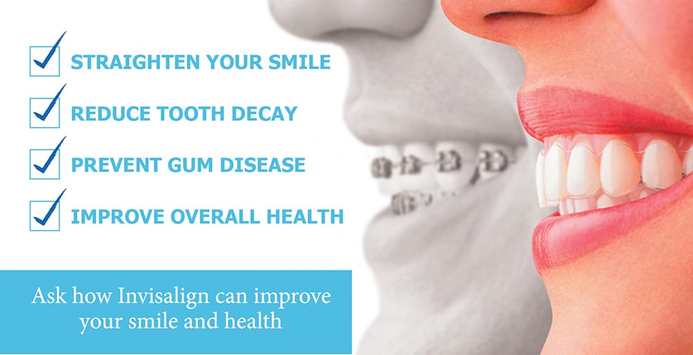Straight talk about crooked teeth! - Shelton Dental Excellence